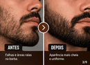 Caneta Fio a Fio para Barba 4 Pontas Kit 2 por 1