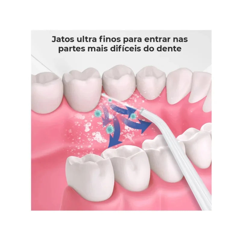 Irrigador Dental para Limpeza Bucal - A Solução Definitiva para Sua Higiene Bucal